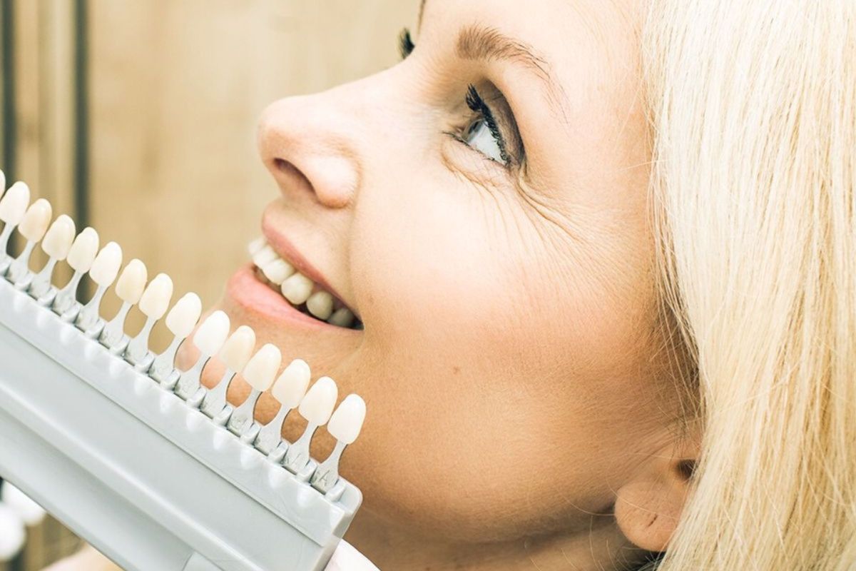 Referência de Clareamento dental