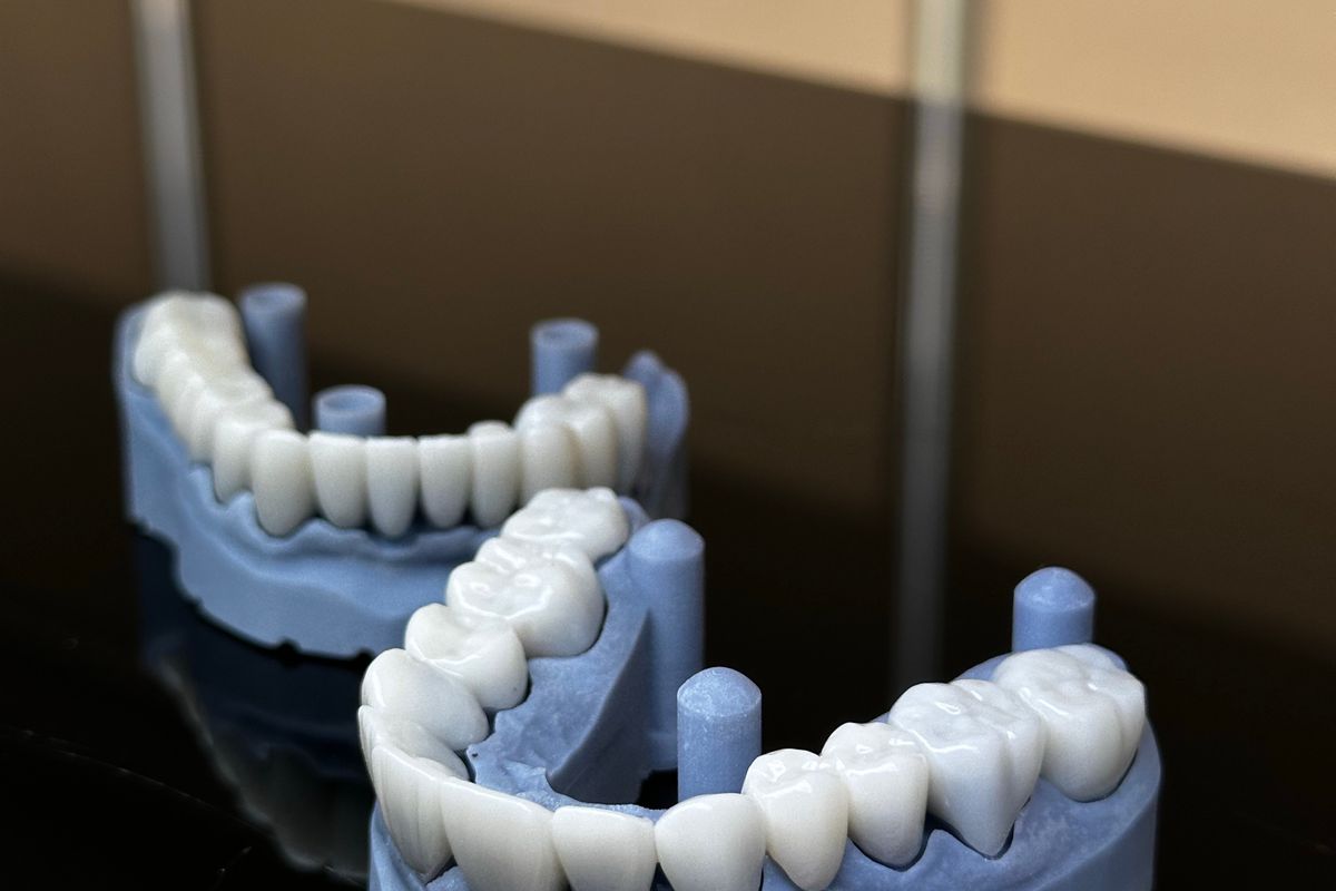 Referência de Implantes